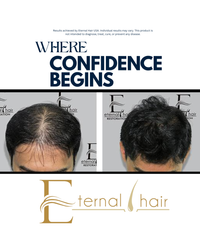 Eternal Hair™ – Men’s Daily Hair Support Supplement