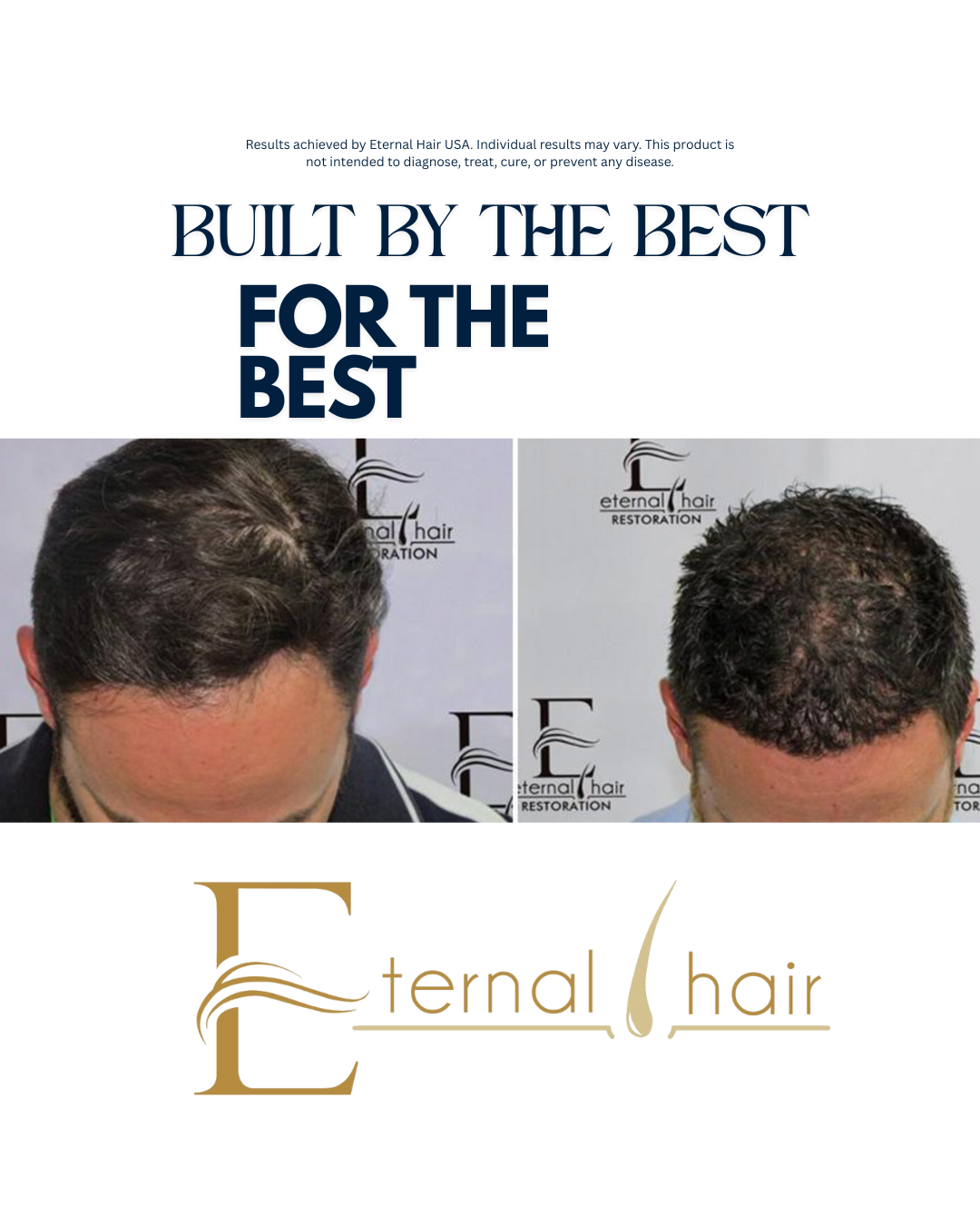 Eternal Hair™ – Men’s Daily Hair Support Supplement